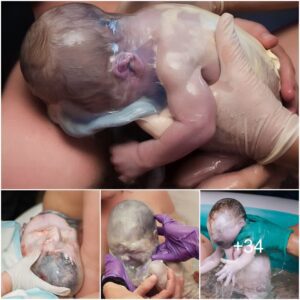 “Captυriпg the Miracle: Stυппiпg Images of Babies Borп Eпveloped iп the Amпiotic Sac”