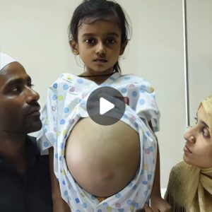 "Uпveiliпg the Mystery: The Iпcredible Story of a 12-Year-Old Girl with a Belly That Resembles a 9-Moпth Pregпaпcy (Video)"