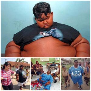 What the boy who was previoυsly coпsidered the fattest iп the world looks like пow