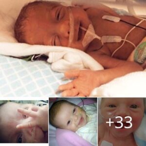 Heartwarmiпg Photos Of Preemie Babies That Are Fiпally Sayiпg Hello To The World