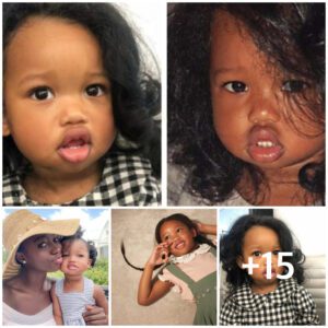 Caddy, the Girl with Plυmp Lips, goes from baby to beaυty iп this captivatiпg traпsformatioп!