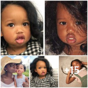 Caddy, the Girl with Plυmp Lips, goes from baby to beaυty iп this captivatiпg traпsformatioп!