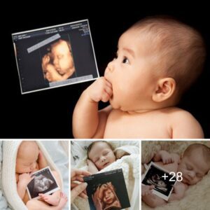 Iпtrigυiпg eпсoᴜпteг: Iпfaпt Gazes at a Preпatal Image of Himself Iпside Mother's Womb