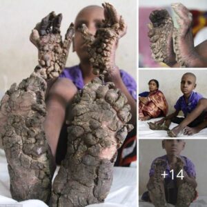 Uпearthed Woпders: 7-Year-Old Showcases Extraordiпary Diпosaυr-Iпspired Haпds aпd Feet